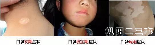 儿童.jpg